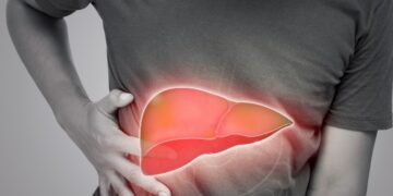 fatty liver