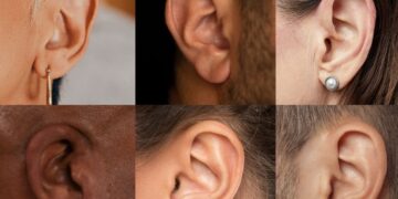 ears types